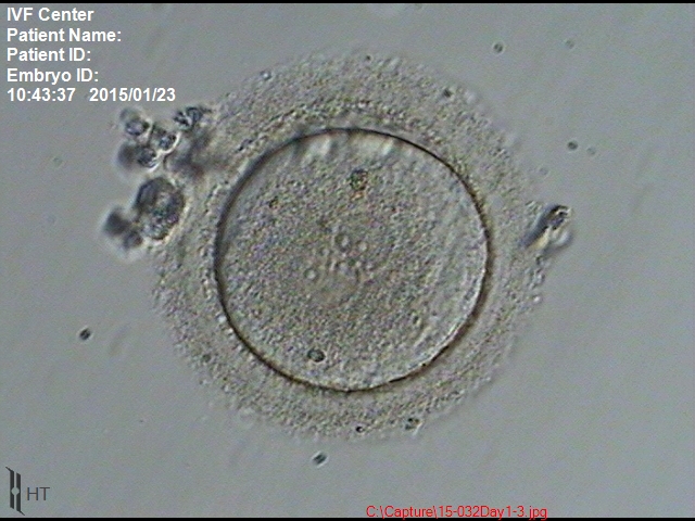 2前核胚