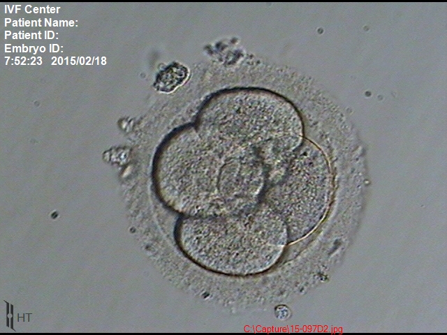 4細胞期胚