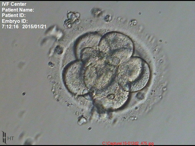8細胞期胚